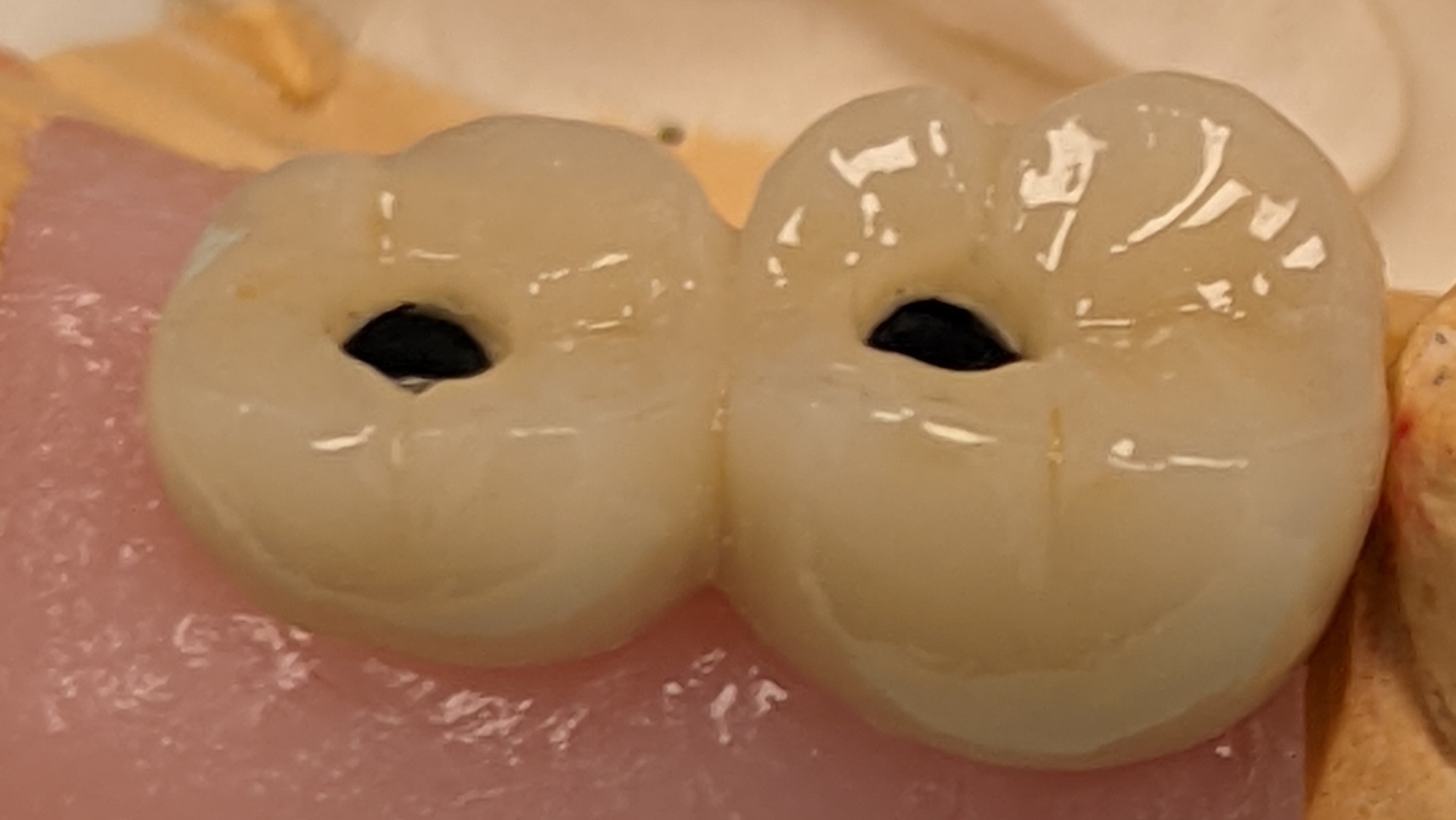 Имплант LENMIRIOT  